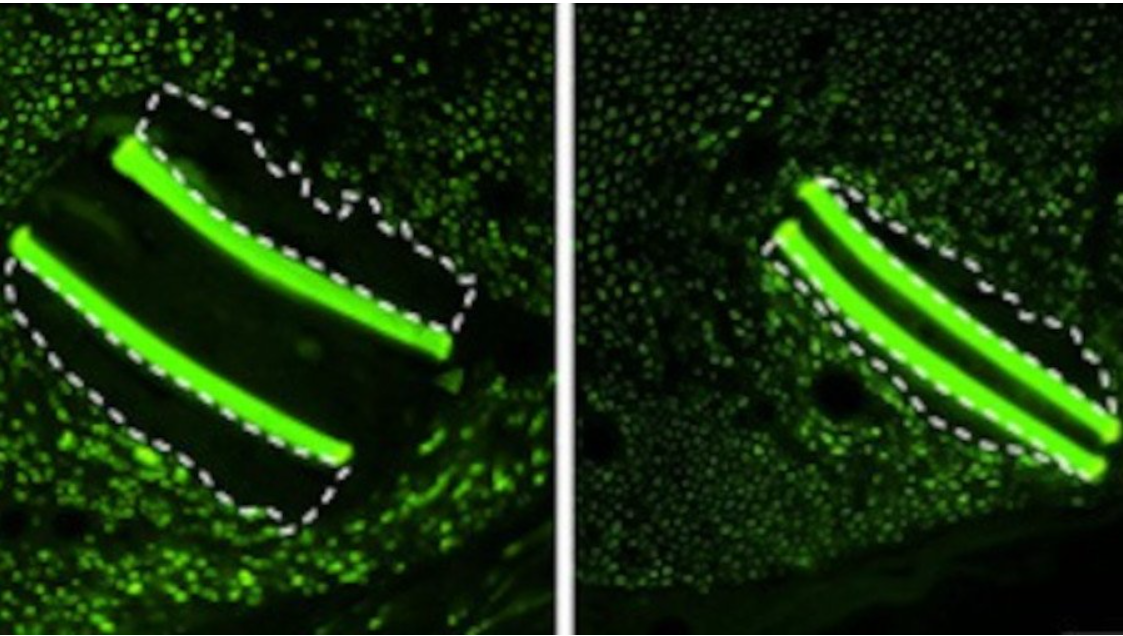 New strategy to improve the body’s tolerance to prosthetic implants