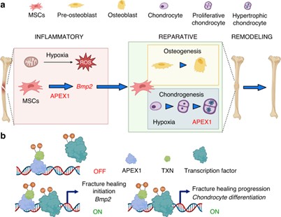 Why some broken bones fail to heal: Scientists reveal a critical molecular trigger