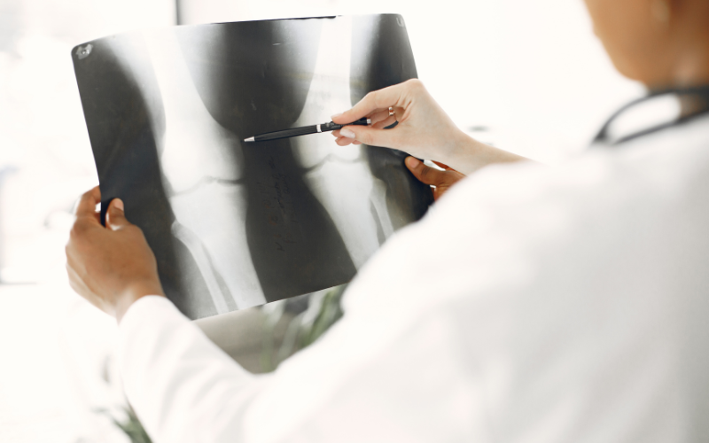 Next-generation bone void fillers transforming orthopaedic care