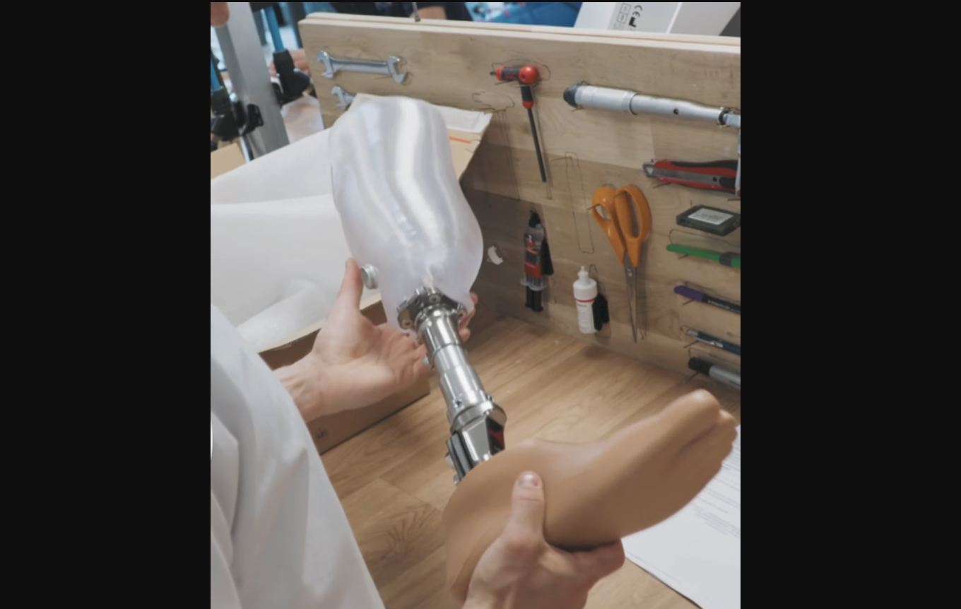 VYTRUVE surpasses 13,000 3D-printed prosthetic sockets